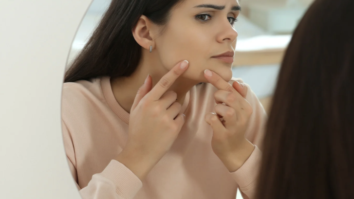 Hormonal Acne Specialist Appointment